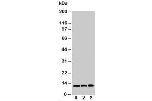 Western blot testing of MIF antibody and Lane 1:  HeLa;  2: COLO320;  3: MM231 cell lysate (MIF antibody  (C-Term))