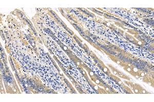 Immunohistochemistry (IHC) image for anti-Receptor (TNFRSF)-Interacting serine-threonine Kinase 1 (RIPK1) (AA 1-179) antibody (ABIN7441205)