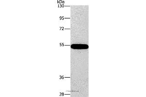 Western blot analysis of 293T cell, using CNDP1 Polyclonal Antibody at dilution of 1:320 (CNDP1 antibody)