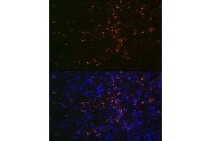 Immunofluorescence analysis of human colon carcinoma using FUT4 Rabbit pAb (ABIN7267274) at dilution of 1:100 (40x lens).