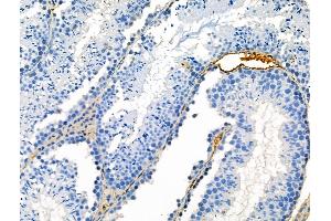 ABIN7093245 and ABIN7097262 at 1/100 staining Mouse testis tissue by IHC-P.