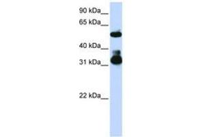 Image no. 1 for anti-F-Box and WD Repeat Domain Containing 2 (FBXW2) (C-Term) antibody (ABIN6740796)