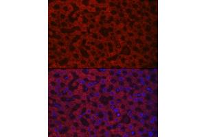 Immunofluorescence analysis of rat liver cells using H/GOX Rabbit pAb (ABIN6131795, ABIN6141599, ABIN6141600 and ABIN6222127) at dilution of 1:100 (40x lens). (HAO1 antibody  (AA 1-370))