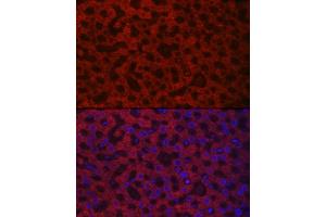 Immunofluorescence analysis of rat liver cells using H/GOX Rabbit pAb (ABIN6131795, ABIN6141599, ABIN6141600 and ABIN6222127) at dilution of 1:100 (40x lens). (HAO1 antibody  (AA 1-370))