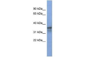 WB Suggested Anti-RBM9 Antibody Titration:  0. (RBM9 antibody  (Middle Region))