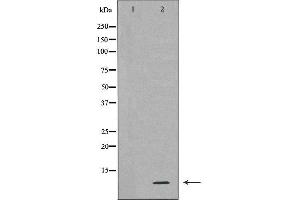 Western blot analysis of extracts of HL-60 , using RPS27A antibody. (RPS27A antibody  (Internal Region))