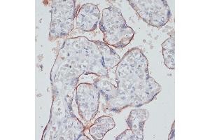 Immunohistochemistry (IHC) image for anti-Transferrin Receptor (p90, CD71) (TFRC) (AA 1-140) antibody (ABIN6149065)