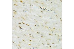 Immunohistochemistry of paraffin-embedded rat heart using ADAR antibody. (ADAR antibody  (AA 150-250))