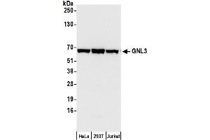 Western Blotting (WB) image for anti-Guanine Nucleotide Binding Protein-Like 3 (Nucleolar) (GNL3) (C-Term) antibody (ABIN7453884)