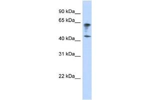 WB Suggested Anti-IGSF11 Antibody Titration:  0. (IGSF11 antibody  (Middle Region))