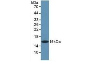 Detection of Recombinant GMCSF, Human using Polyclonal Antibody to Colony Stimulating Factor 2, Granulocyte Macrophage (GM-CSF) (GM-CSF antibody  (AA 18-144))