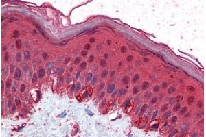Human Skin (formalin-fixed, paraffin-embedded) stained with TFAP2C antibody ABIN351479 at 2. (TFAP2C antibody  (AA 270-281))