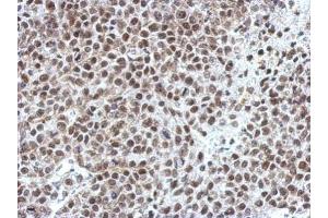 IHC-P Image Immunohistochemical analysis of paraffin-embedded Hela xenograft, using OCT1, antibody at 1:750 dilution. (POU2F1 antibody)