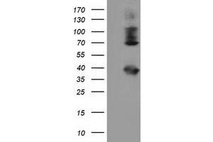 HEK293T cells were transfected with the pCMV6-ENTRY control (Left lane) or pCMV6-ENTRY HSPA6 (Right lane) cDNA for 48 hrs and lysed. (HSPA6 antibody)