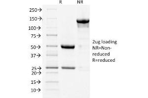 SDS-PAGE Analysis Purified COX-2 Mouse Monoclonal Antibody (COX2/1941).
