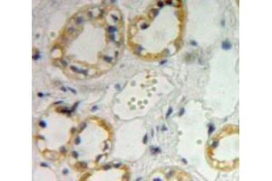 Used in DAB staining on fromalin fixed paraffin-embedded kidney tissue (IL4 Receptor antibody  (AA 26-233))