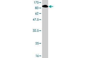 Western Blot detection against Immunogen (97. (RECQL4 antibody  (AA 1-652))