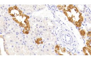 Immunohistochemistry (IHC) image for anti-Tumor Necrosis Factor Receptor Superfamily, Member 10b (TNFRSF10B) (AA 234-435) antibody (ABIN7442663)