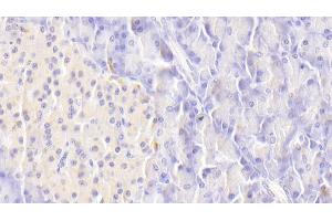 Immunohistochemistry (IHC) image for anti-Tumor Necrosis Factor Receptor Superfamily, Member 10b (TNFRSF10B) (AA 234-435) antibody (ABIN7442663)