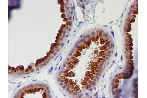 Immunohistochemical staining of paraffin-embedded Human breast tissue using anti-MEF2C mouse monoclonal antibody. (MEF2C antibody)
