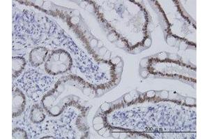 Image no. 1 for anti-Transcription Factor 7-Like 2 (T-Cell Specific, HMG-Box) (TCF7L2) (AA 1-456) antibody (ABIN466103) (TCF7L2 antibody  (AA 1-456))