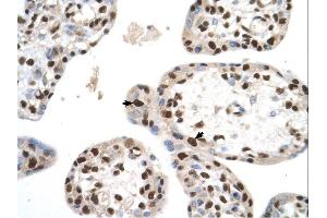 SETD2 antibody was used for immunohistochemistry at a concentration of 4-8 ug/ml. (SETD2 antibody  (N-Term))