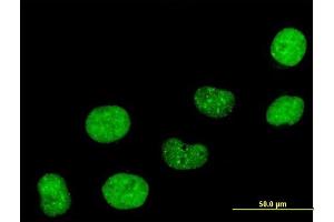 Immunofluorescence of purified MaxPab antibody to CBX5 on HeLa cell. (CBX5 antibody  (AA 1-191))