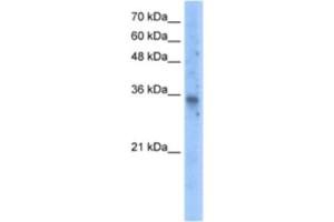 Western Blotting (WB) image for anti-Solute Carrier Family 25 (Mitochondrial Carrier, Graves Disease Autoantigen), Member 16 (SLC25A16) antibody (ABIN2462778) (SLC25A16 antibody)