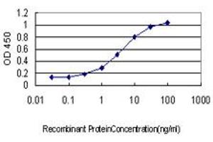 Detection limit for recombinant GST tagged LGALS8 is approximately 0. (LGALS8 antibody  (AA 1-358))