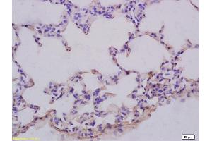 Formalin-fixed and paraffin embedded rat lung labeled with Anti-GRB10 Polyclonal Antibody, Unconjugated (ABIN680428) at 1:200 followed by conjugation to the secondary antibody and DAB staining (GRB10/14 (AA 501-594) antibody)
