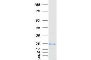 Validation with Western Blot (TMED9 Protein (Myc-DYKDDDDK Tag))