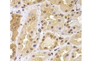 Immunohistochemistry of paraffin-embedded Human kidney using PHF21B Polyclonal Antibody at dilution of 1:100 (40x lens). (PHF21B antibody)