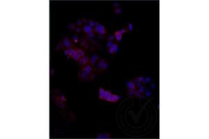 Independently Validated Antibody, image provided by Science Direct, badge number 029611:Formalin-fixed MCF7 cells labeled with Anti-Megalin Polyclonal Antibody, Cy3 Conjugated (ABIN750991) at 1:250 overnight at 4C. (LRP2 antibody  (AA 3401-3500))
