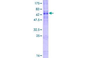 Image no. 1 for ALG3, alpha-1,3- mannosyltransferase (ALG3) (AA 1-438) protein (GST tag) (ABIN1344878) (ALG3 Protein (AA 1-438) (GST tag))