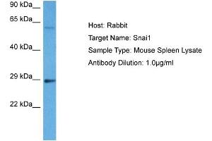 Western Blotting (WB) image for anti-SNAIL (SNAI1) (N-Term) antibody (ABIN2777858)