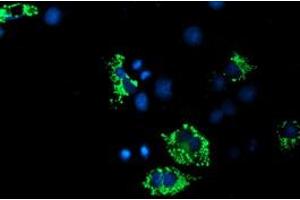 Anti-ACSF2 mouse monoclonal antibody (ABIN2455778) immunofluorescent staining of COS7 cells transiently transfected by pCMV6-ENTRY ACSF2 (RC204368). (ACSF2 antibody)