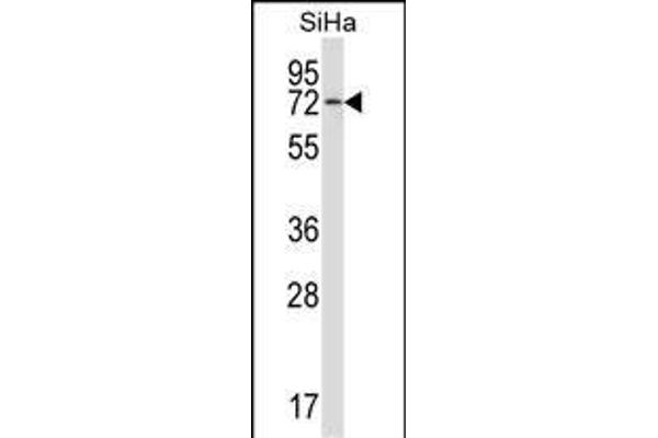 HSPA12B anticorps  (N-Term)