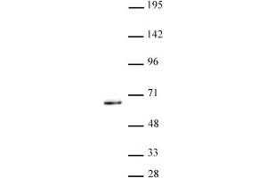 KLF5 antibody (pAb) tested by Western Blot. (KLF5 antibody  (N-Term))
