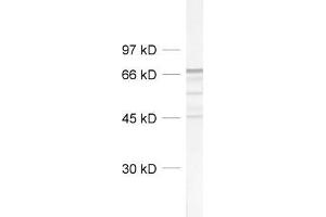dilution: 1 : 1000, sample: rat brain homogenate (NEFL antibody  (AA 1-284))