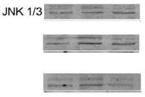 Image kindly provided by Dr. (JNK antibody  (AA 201-300))