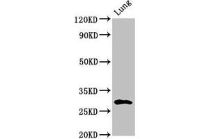Western Blot Positive WB detected in: Rat lung tissue All lanes: SYNPR antibody at 3 μg/mL Secondary Goat polyclonal to rabbit IgG at 1/50000 dilution Predicted band size: 30, 32 kDa Observed band size: 30 kDa (Synaptoporin antibody  (AA 199-265))