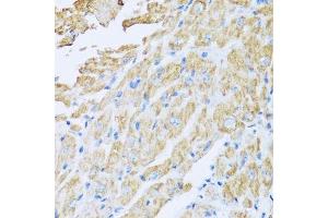 Immunohistochemistry of paraffin-embedded mouse heart using IL18BP antibody. (IL18BP antibody  (AA 31-194))