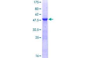 MED20 Protein (AA 1-212) (GST tag)