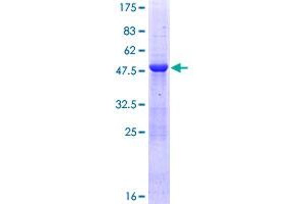 MED20 Protein (AA 1-212) (GST tag)