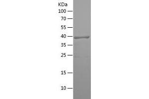 Western Blotting (WB) image for Arginine (ARG) (AA 240-354) protein (His tag) (ABIN7121888) (Arginine Protein (ARG) (AA 240-354) (His tag))