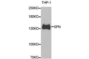 Western blot analysis of extracts of THP-1 cell line, using SPN antibody.