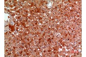 Immunohistochemistry (IHC) analysis of paraffin-embedded Human Liver, antibody was diluted at 1:100. (alpha 2 Macroglobulin antibody  (Internal Region))