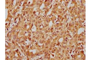 Immunohistochemistry (IHC) image for anti-Integrin beta 1 (ITGB1) antibody (ABIN7127584)