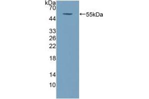 Western blot analysis of recombinant Human COQ6. (COQ6 antibody  (AA 1-468))