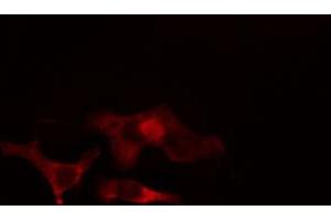 ABIN6266897 staining HeLa cells by IF/ICC. (ELOVL4 antibody  (Internal Region))